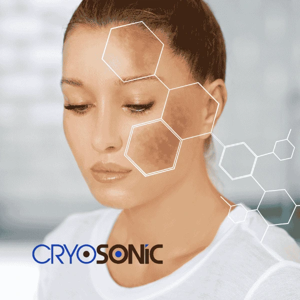 Are you looking for age spot removal treatment? Contact Cryosonic today in Cirencester