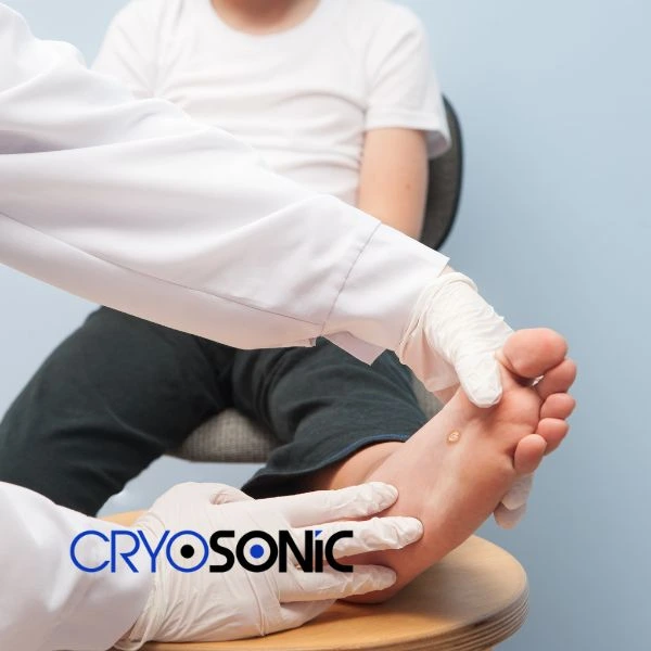 Are you looking for fast effective wart removal Contact us today Cirencester
